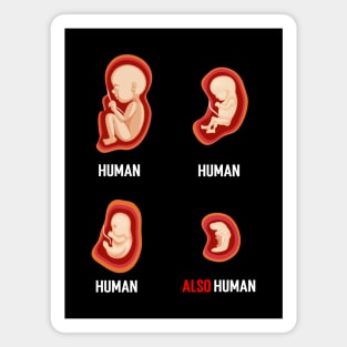 Even a Fetus is a human....Abortion choice Quotes Magnet